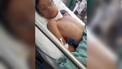 米国目指した１０歳少年、メキシコで襲われ重傷　父の遺体と路上に放置