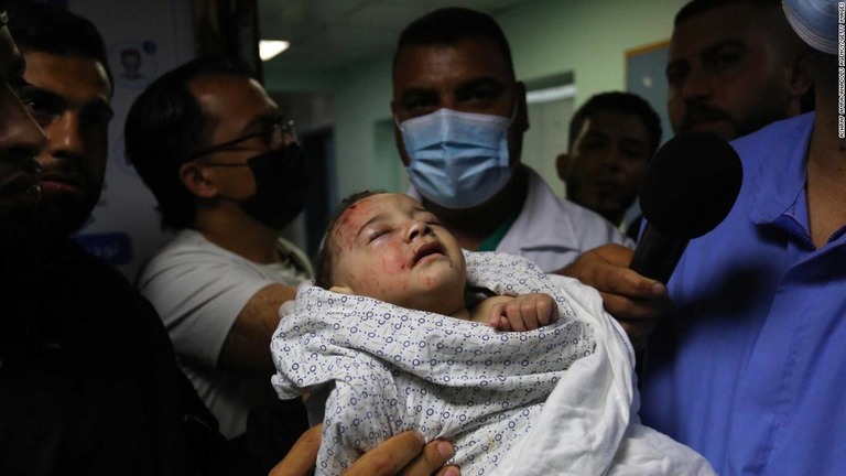 病院に搬送された赤ちゃん。一家１０人が空爆によって死亡したとみられている/Ashraf Amra/Anadolu Agency/Getty Images